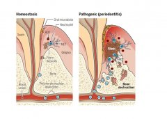 富氢水对牙周炎的作用及机制的研究进展
