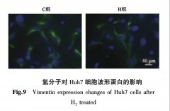 氢分子对肝癌细胞Huh7的影响