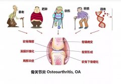 氢气饱和等渗盐水腹腔注射治疗兔创伤性