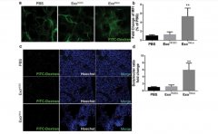 富氢水抑制TGF-β1/α-SMA/Col1α1通路调控内质