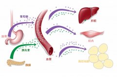 氢分子调节2型糖尿病血糖代谢和胰岛素抵