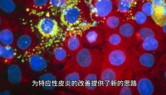 氢分子改善特应性皮炎