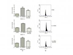 TLR4/NF-κB信号通路在富氢水改善电离辐射致大鼠放射性脑损伤中的作用