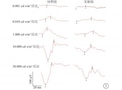 MNU诱导大鼠视网膜色素变性的时空特点及氢分子对其保护作用研究